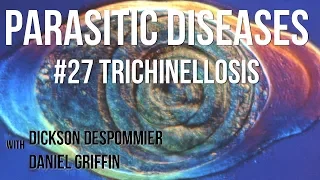 Parasitic Diseases Lectures #27: Trichinellosis