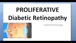 Ophthalmology 285 PDR Proliferative Diabetic Retinopathy Maculopathy Advanced eye disease Tractional