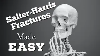 Salter-Harris Fracture Classification System Mnemonic: Type 1, 2, 3, 4, 5: Quick & EZ [Episode 11]