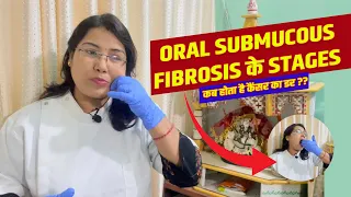 Oral SUBMUCOUS fibrosis के stages…कब होता है कैंसर का डर ??