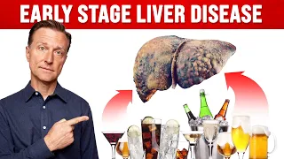 How Much Alcohol Would You Have to Drink Before Liver Damage