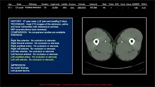 137 Years of Medical Malpractice Part 9 of 9 | Free Radiology CME