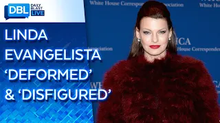 See Photos: Linda Evangelista Says Fat-Freezing Procedure Left Her 'Brutally Disfigured'