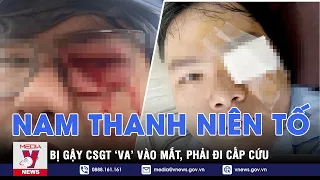 Tin chiều ngày 22/8. Công an xác minh vụ nam thanh niên tố bị gậy CSGT “va” vào mắt, phải cấp cứu