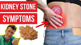 What symptoms do KIDNEY STONES cause? Doctor explains...PLUS how kidney stones are diagnosed & more!