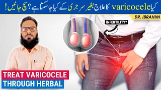Varicocele Ka Ilaj - Treat Varicocele Naturally with Herbal Medicine - Urdu/Hindi - Dr. Ibrahim
