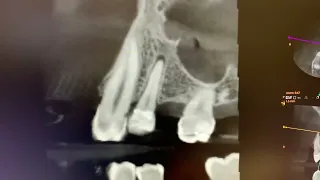 2D and 3D Xrays