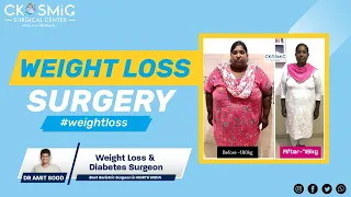 100KGS WEIGHT LOSS SURGERY SUCCESS STORY| DR AMIT SOOD| BEST BARIATRIC SURGEON IN LUDHIANA PUNJAB