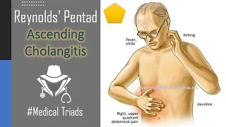 Reynolds Pentad of Ascending Cholangitis // #Shorts #Medical_shorts