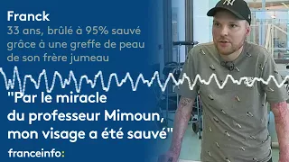 Franck : "Par le miracle du professeur Mimoun, mon visage a été sauvé""