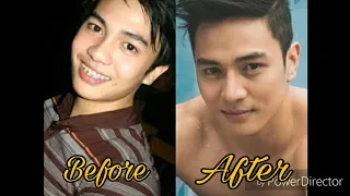 before and after ng mga sikat na celebrity kilalanin | Throwback