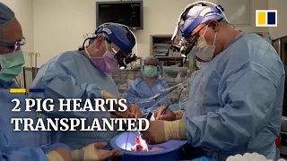 Pig hearts successfully transplanted in brain-dead patients