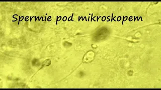 Spermie pod mikroskopem