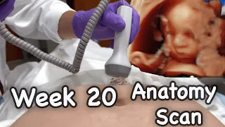 My Week 20 Ultrasound at High Risk Maternal Fetal Medicine MFM Vlog