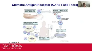 Relapsed and Refractory Diffuse Large B-Cell Lymphoma