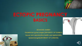 ECTOPIC PREGNANCY DIAGNOSIS AND MANAGEMENT BASICS