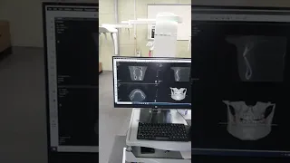 Used/Refurbished Digital Dental Xray/CBCT with WARRANTY - Vatech Pax I 3D CT FOV 12X9 with Cephalo