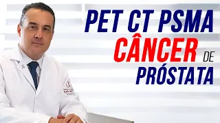 Pet CT PSMA para câncer de prostata  - Com Dr. André Matos Urologista