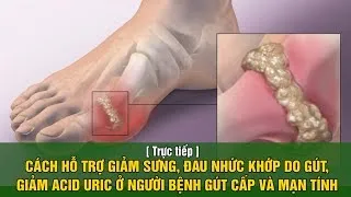 PHƯƠNG PHÁP GIÚP HỖ TRỢ GIẢM SƯNG, ĐAU KHỚP, ACID URIC Ở NGƯỜI BỆNH GOUT CẤP VÀ MÃN TÍNH