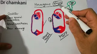 CVS 250 || Neurogenic shock || loss of Vasomotor tone