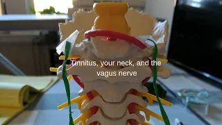 Tinnitus and the Vagus Nerve