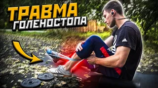 Восстановление голеностопа