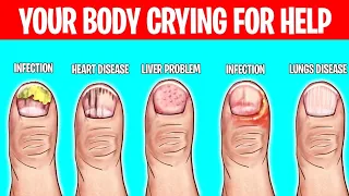 6 WEIRD Ways Your Body Tells You Have a Disease