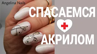 СПАСАЕМСЯ ОТ АЛЛЕРГИИ на базу  / теперь только такая коррекция ногтей  / материал с запахом /