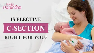 Should You Have an Elective C-Section?