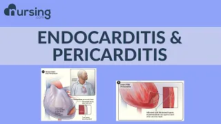 Lets break down these two big words!! "Endocarditis and Pericarditis" (Nursing School Lesson)