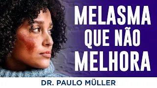 Por que o meu Melasma Não Melhora? – Dr. Paulo Müller Dermatologista.