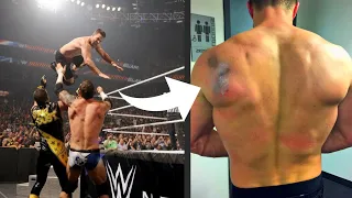 Celebrities Who Were Injured by WWE Wrestlers