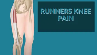 Do you have Runner's Knee pain from the IT Band?