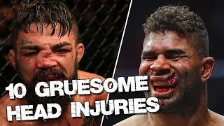 GRUESOME! 10 MMA Fighters Who Got BADLY Hurt!