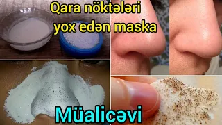 Qara noktelere qarsi maska