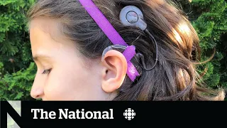 Costs to maintain cochlear implants prohibitive for those who rely on them