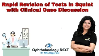 Important Tests of Squint with Clinical Case Discussion