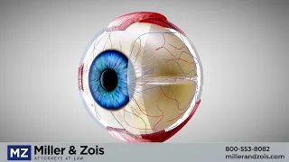 Macular Degeneration and Elmiron