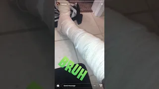 One of the Goons Looking for 6ix9ine Got Shot in the Leg and Posted it on IG