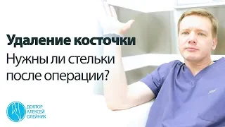 Удаление косточки: нужны ли стельки после операции? | Доктор Алексей Олейник