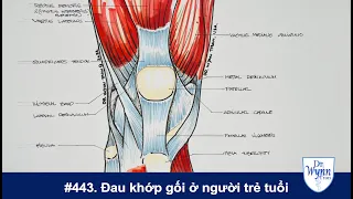 #443. Nguyên nhân và cách chữa trị đau khớp gối ở người trẻ