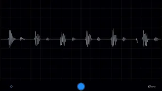 Nervous Heartbeat 😱❤️🩺 [Male Heartbeat]