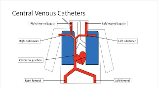 IV Access, CVCs, and ETTs