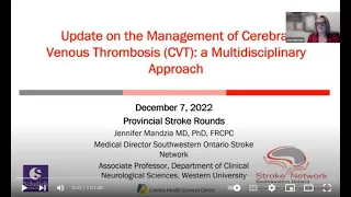 Update on the Management of Cerebral Venous Thrombosis (CVT)