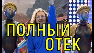 Проскурякова не осознала. Тяжёлое состояние Игоря Николаева усугубилось.