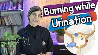 Burning while urination | treatment and causes