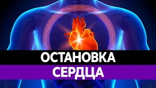 ОСТАНОВКА СЕРДЦА. ИНФАРКТ. СЕРДЕЧНЫЙ ПРИСТУП.