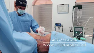 Colombian Liposculpture™ | Eterna MD Medical Rejuvenation Center | Orlando, FL