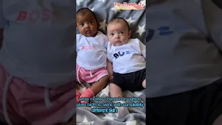 A mother gives birth to twins with different skin tones #shorts