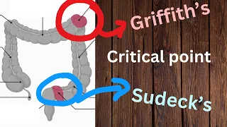 Griffith's and Sudeck's point - IN ONE MINUTE